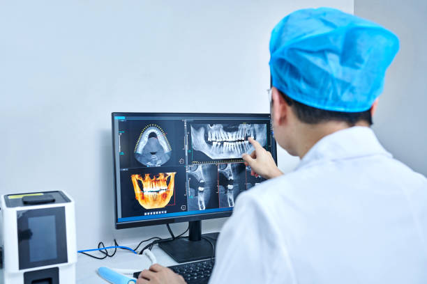 Best Emergency Tooth Extraction in Waynesville, OH