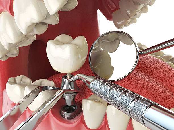 Best Emergency Dental Care for Trauma or Injury in Waynesville, OH